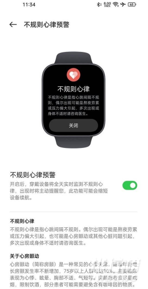 OPPO Watch 2 ECG版评测_OPPO Watch 2 ECG版评测表现