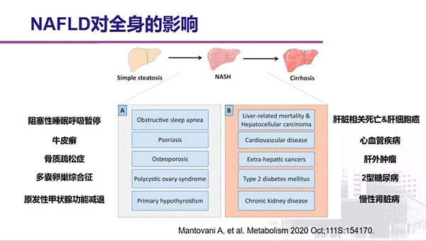 首个全国多中心代谢相关脂肪性肝病（MAFLD）流行病学调查研究项目正式启动 将在美年大健康全国范围内体检中心开展