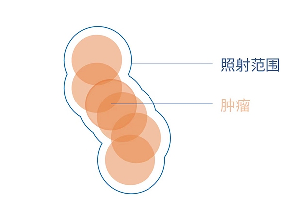 肺癌放疗到底照射哪里？4D扫描观看呼吸周期中肿瘤运动模式